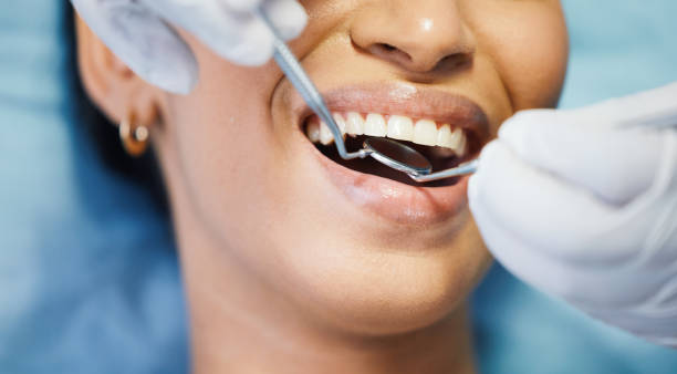 Best Knocked-Out Tooth Emergency  in Oak Harbor, WA