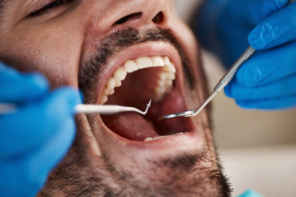 Best Dentist for Tooth Abscess  in Oak Harbor, WA