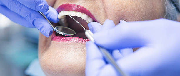 Best Broken Tooth Emergency  in Oak Harbor, WA